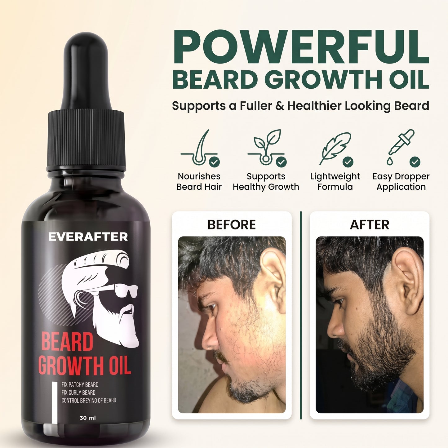 Grow Your Confidence with Premium Beard Growth Oil Solution | Natural Beard & Mustache Growth Serum (30 ml)