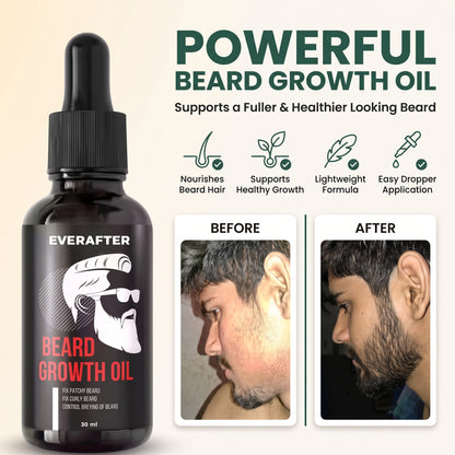 Grow Your Confidence with Premium Beard Growth Oil Solution | Natural Beard & Mustache Growth Serum (30 ml)