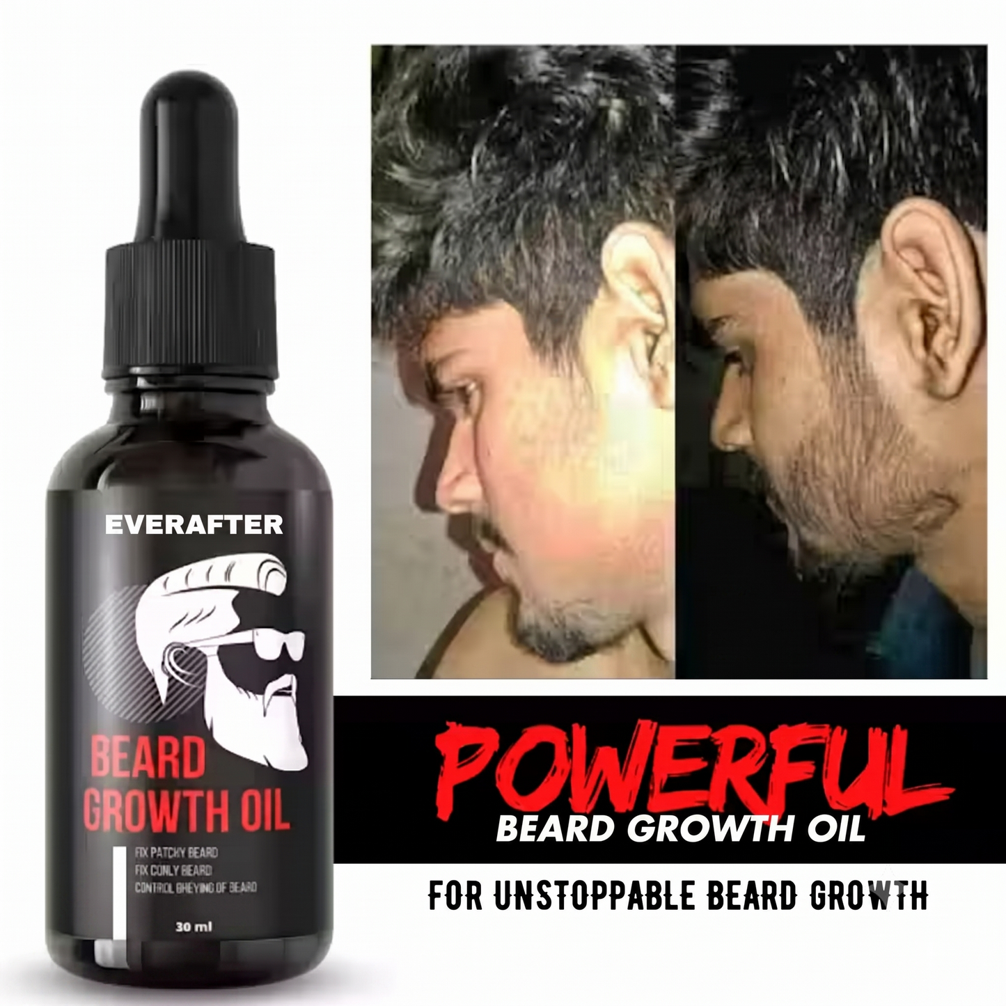 Grow Your Confidence with Premium Beard Growth Oil Solution | Natural Beard & Mustache Growth Serum (30 ml)