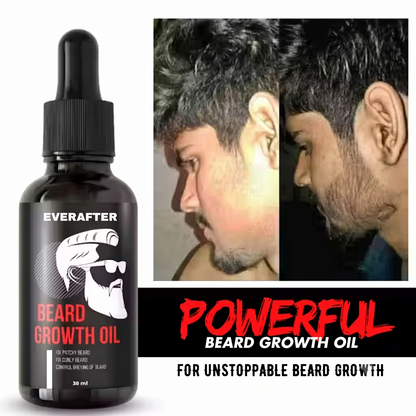 Grow Your Confidence with Premium Beard Growth Oil Solution | Natural Beard & Mustache Growth Serum (30 ml)
